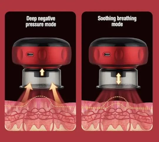 SuctionSpa Massage Cup - Yelopi